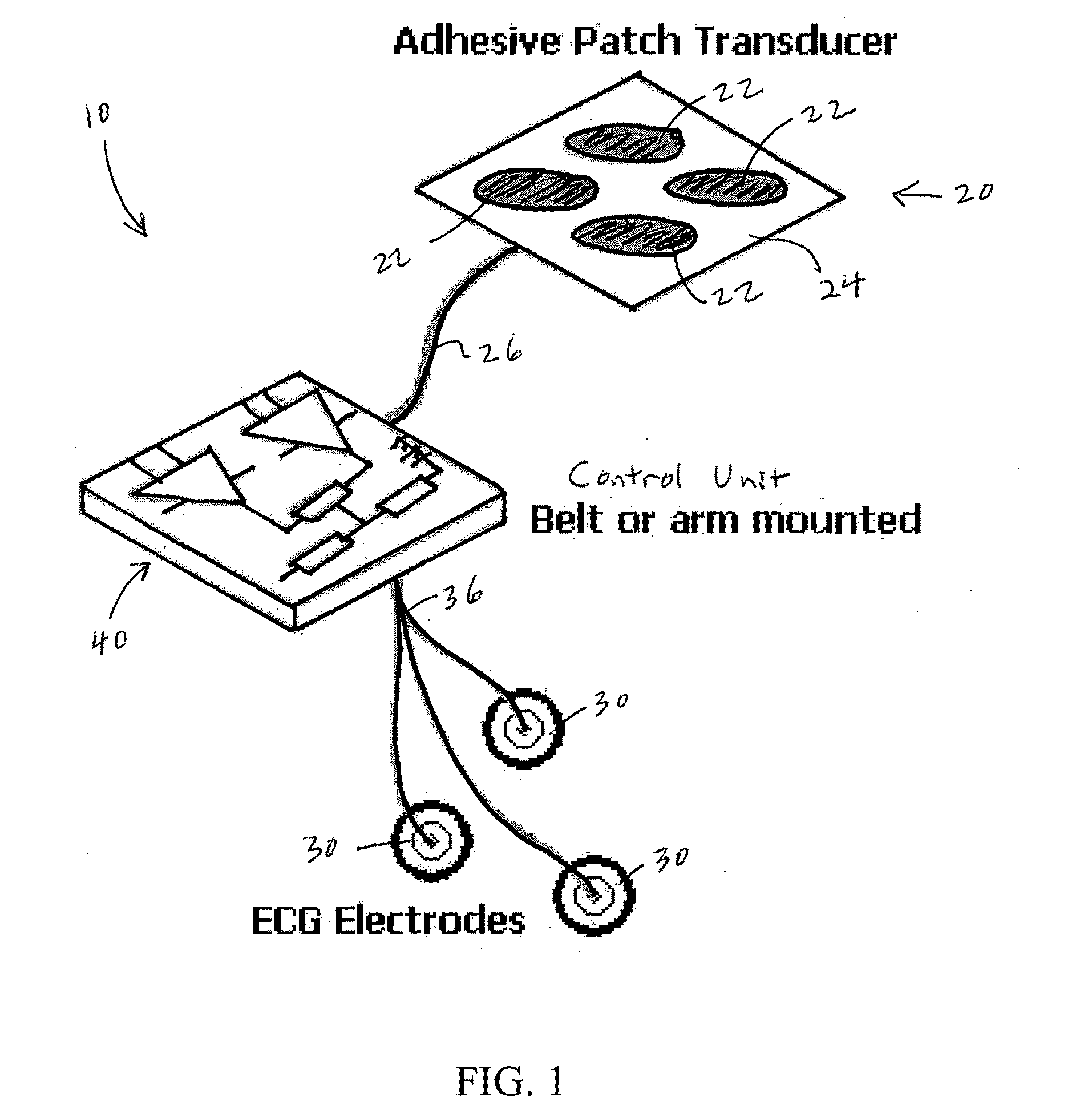 Noninvasive Ultrasound Cardiac Pacemaker and Defibrillator