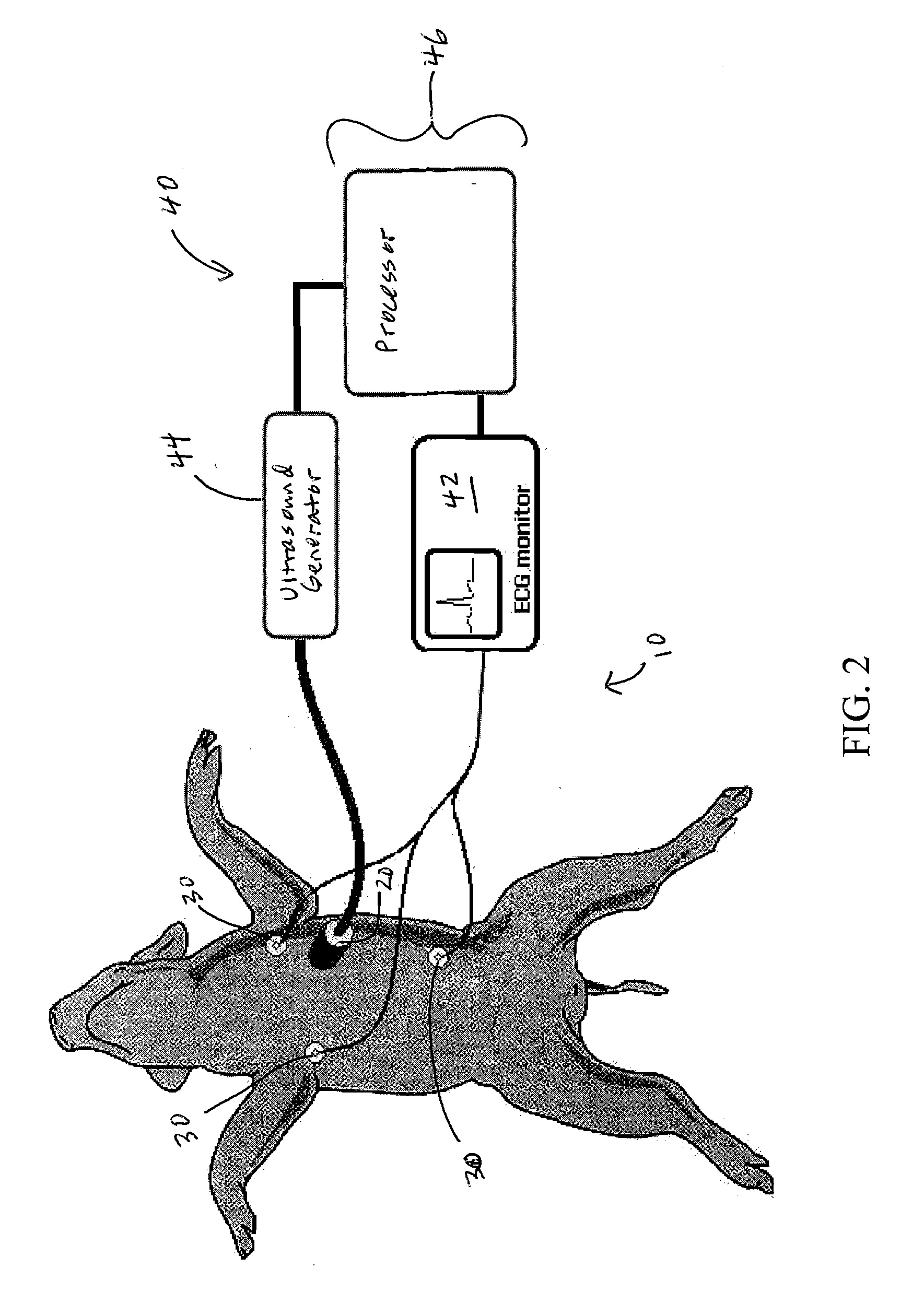 Noninvasive Ultrasound Cardiac Pacemaker and Defibrillator