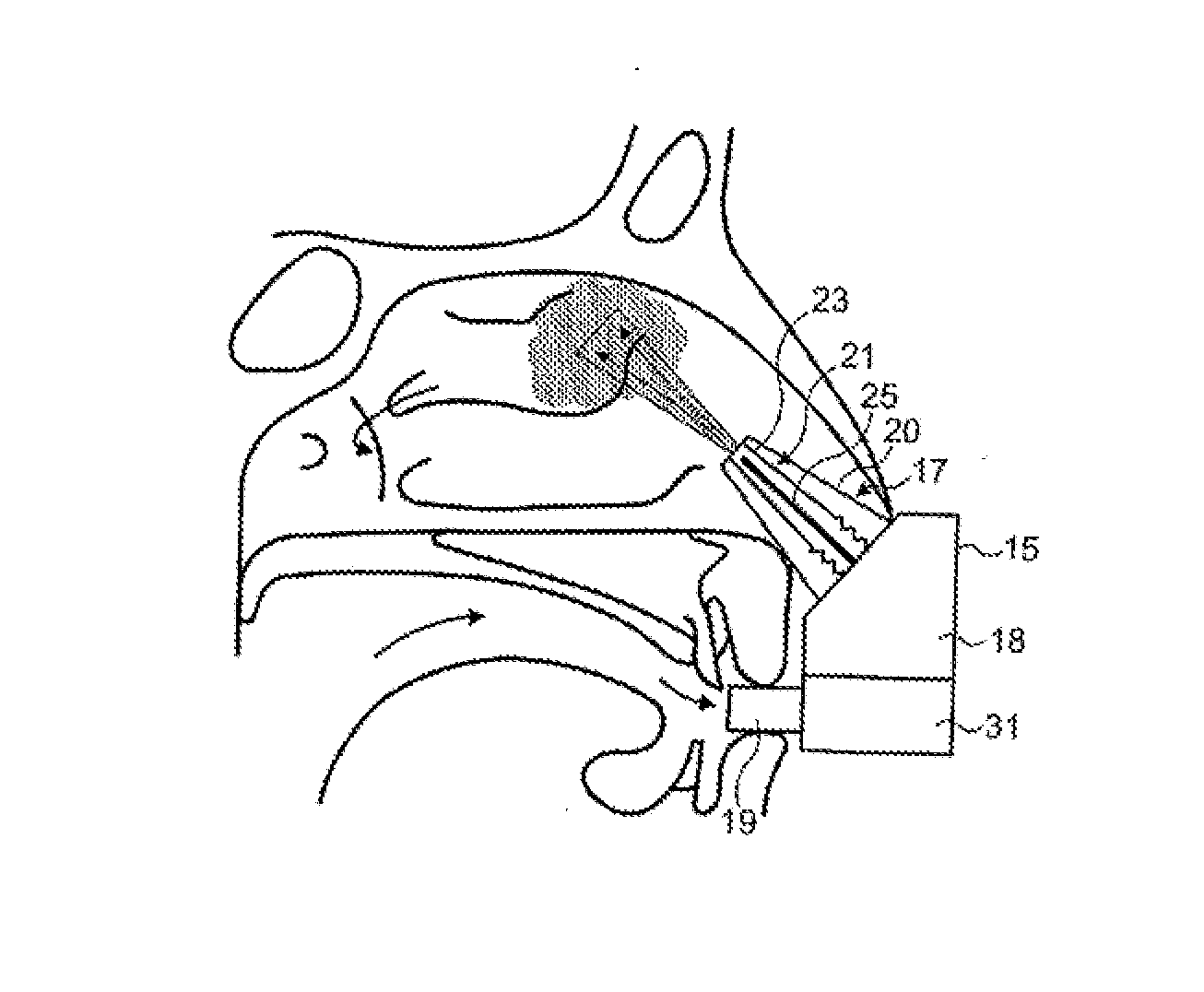 Nasal administration