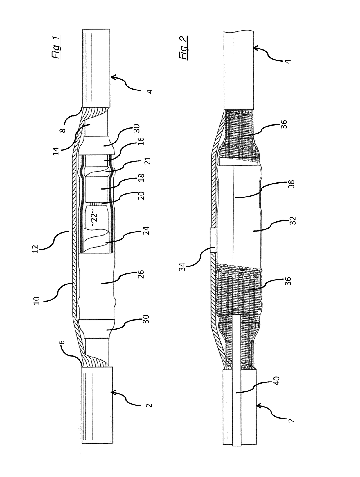 Medium-voltage cable joint