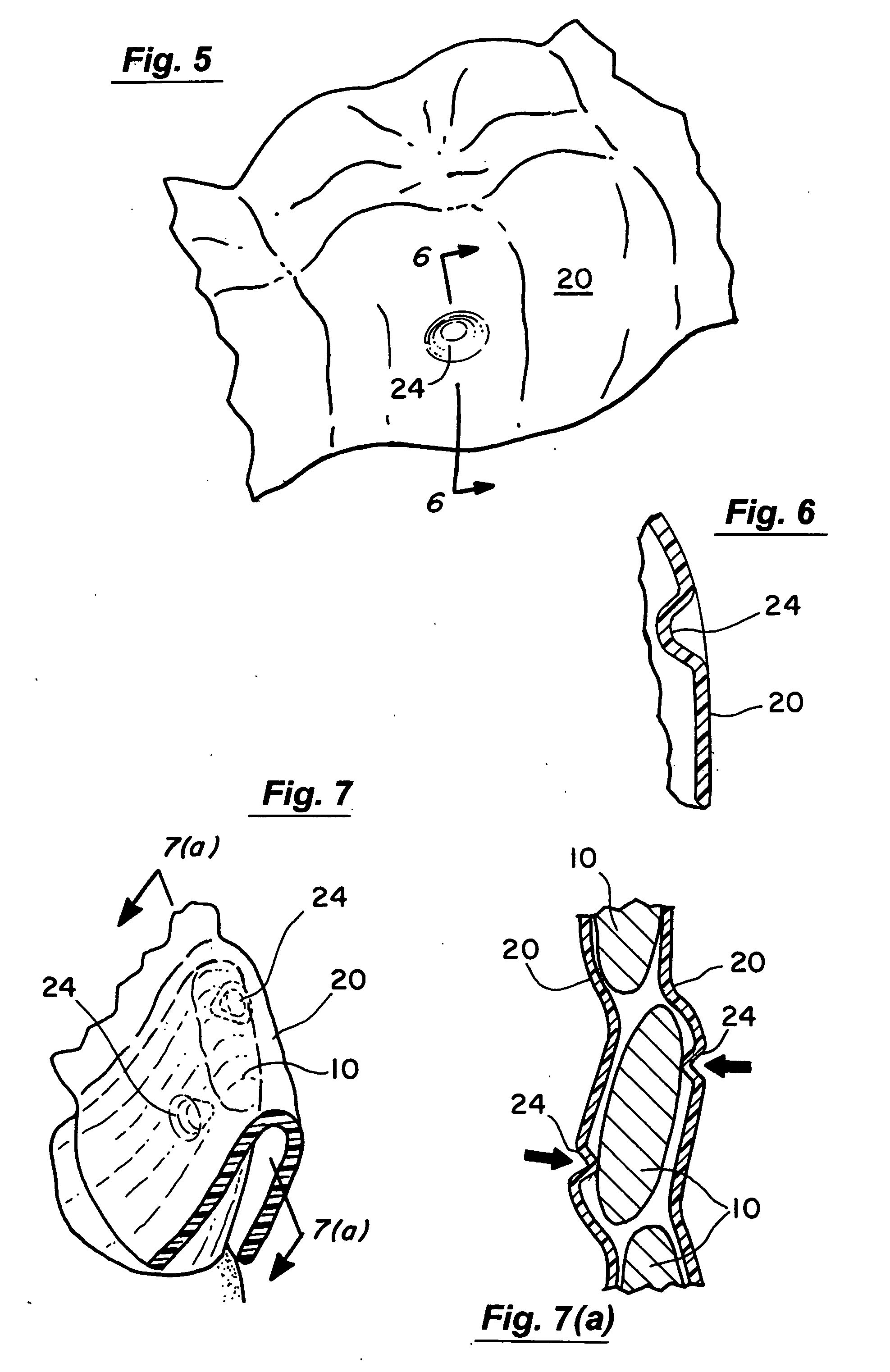 Method for creating features in orthodontic aligners