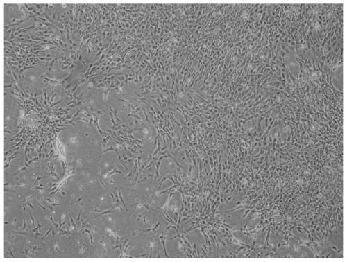 A method for constructing a kidney cell line of Schizothorax dali