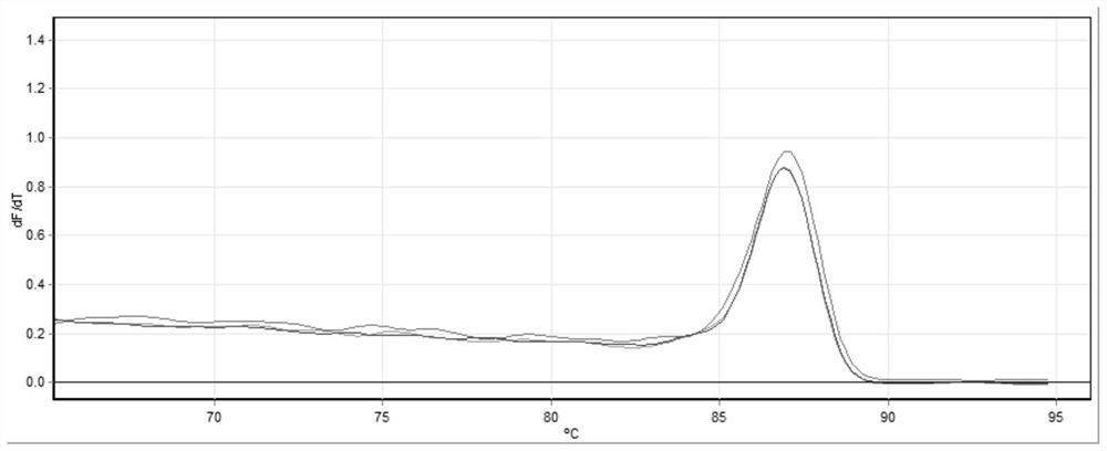 A primer set and method for real-time quantitative PCR detection of differentially expressed genes in the gonads of Acipenser dabfieldii