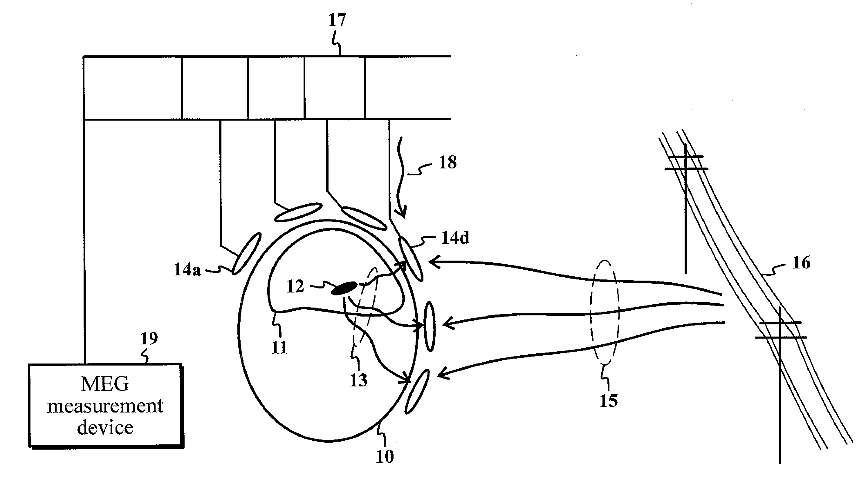 Method and device for recognizing and removing undesired artifacts in multichannel magnetic field or electric potential measurements