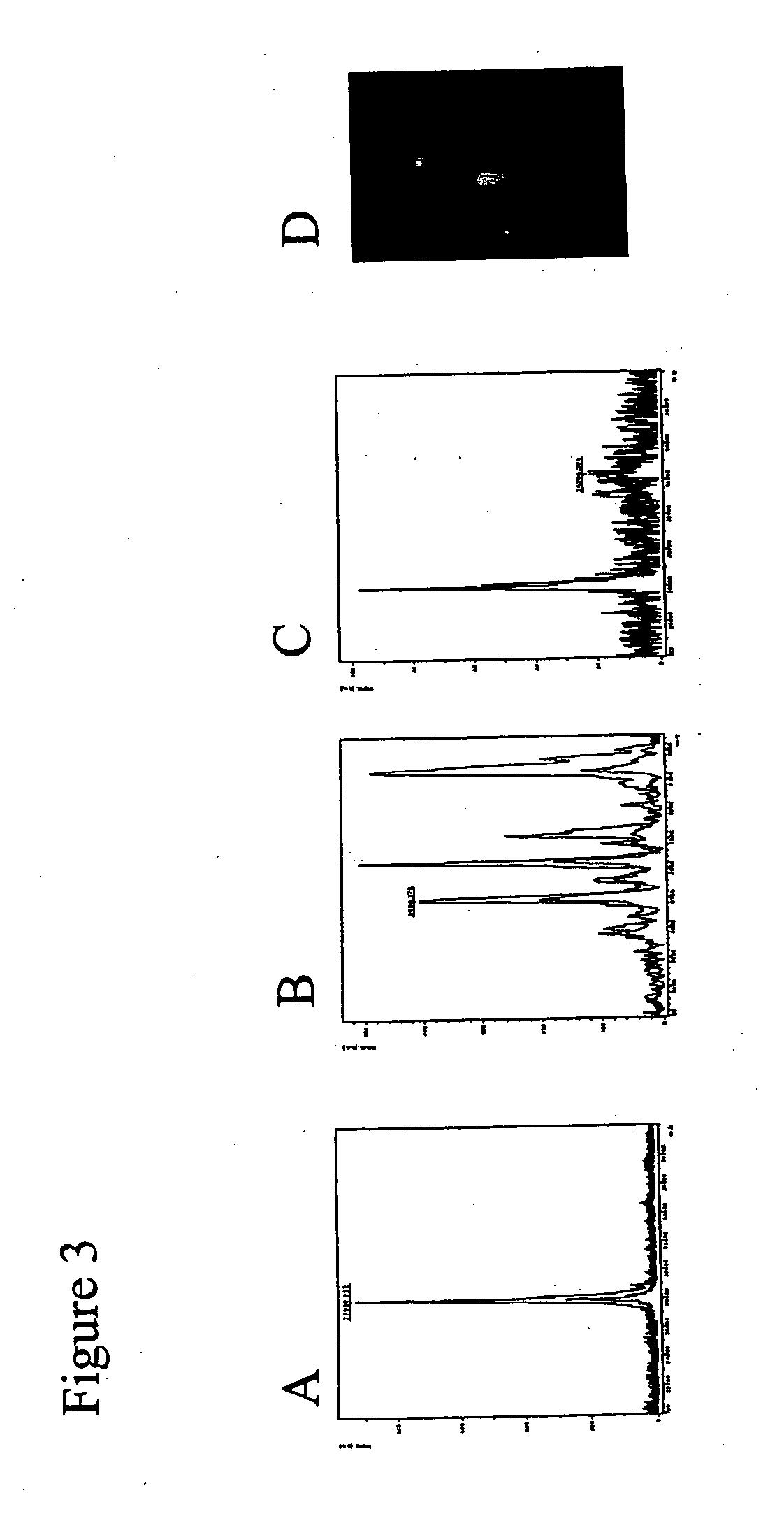 Diagnosis of fetal aneuploidy