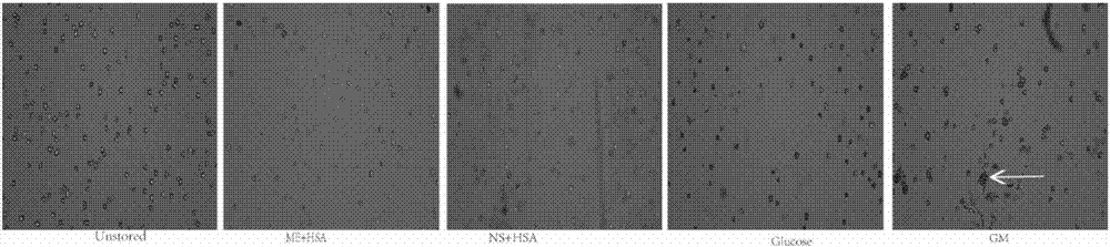 Mesenchymal stem cell low-temperature preserving fluid and preparation method thereof