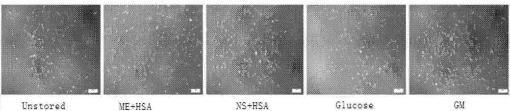 Mesenchymal stem cell low-temperature preserving fluid and preparation method thereof