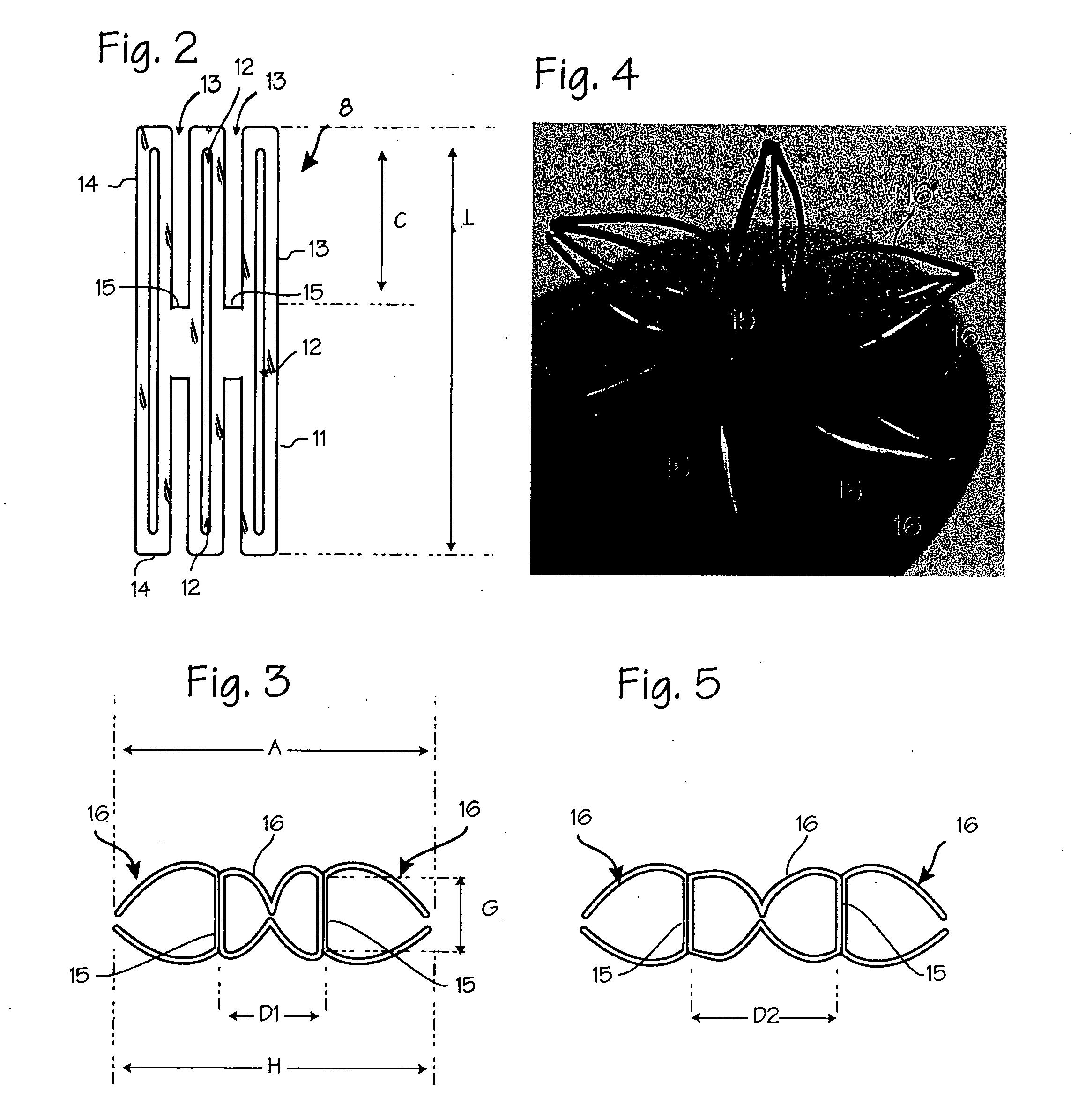 Device and method for establishing an artificial arterio-venous fistula