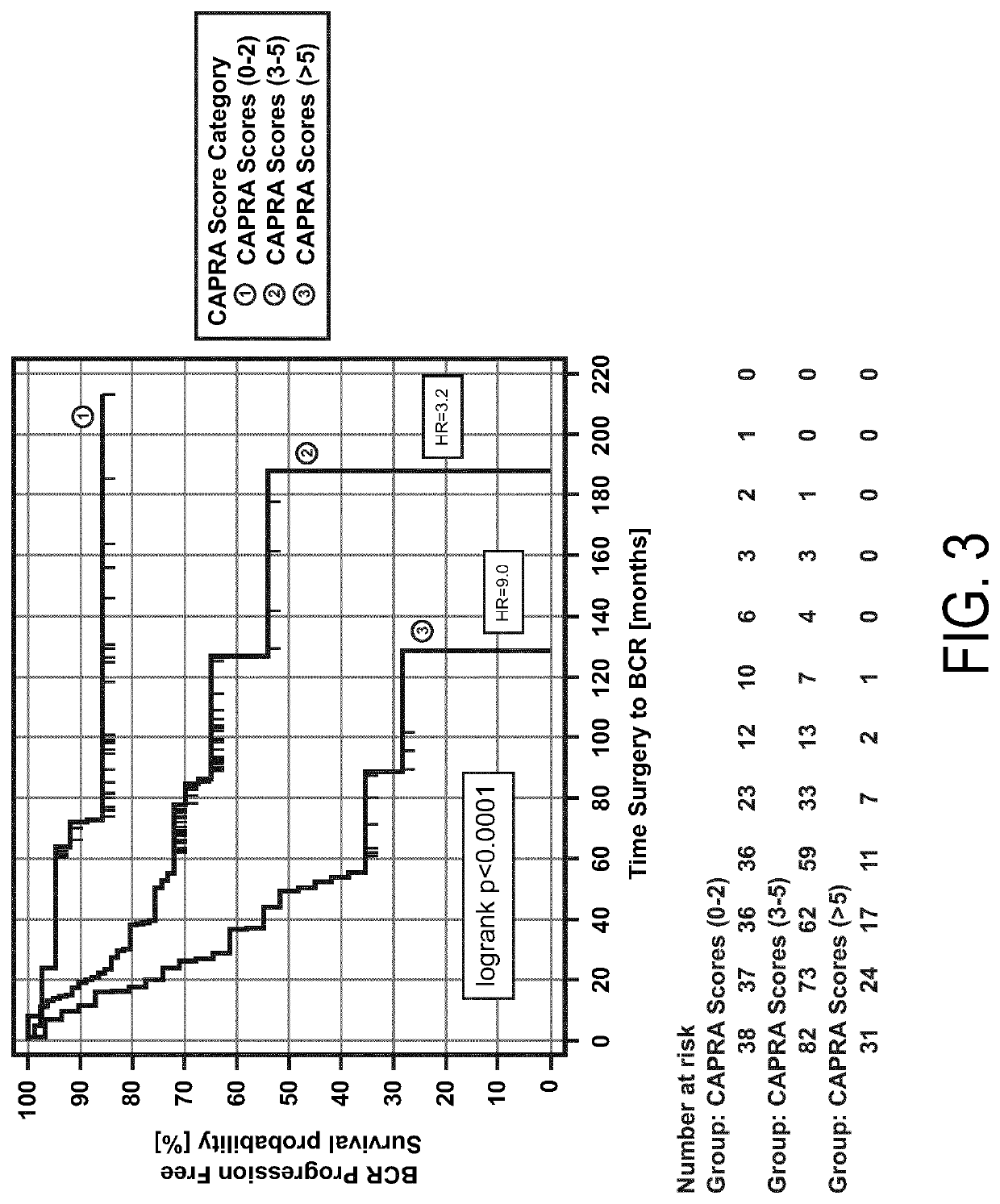 Pre-surgical risk stratification based on pde4d7 expression and pre-surgical clinical variables