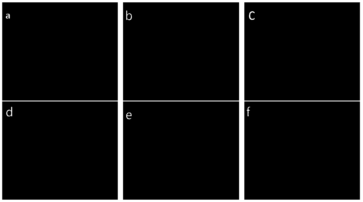 Medical dressing hydrogel composite fabric as well as preparation method and application thereof