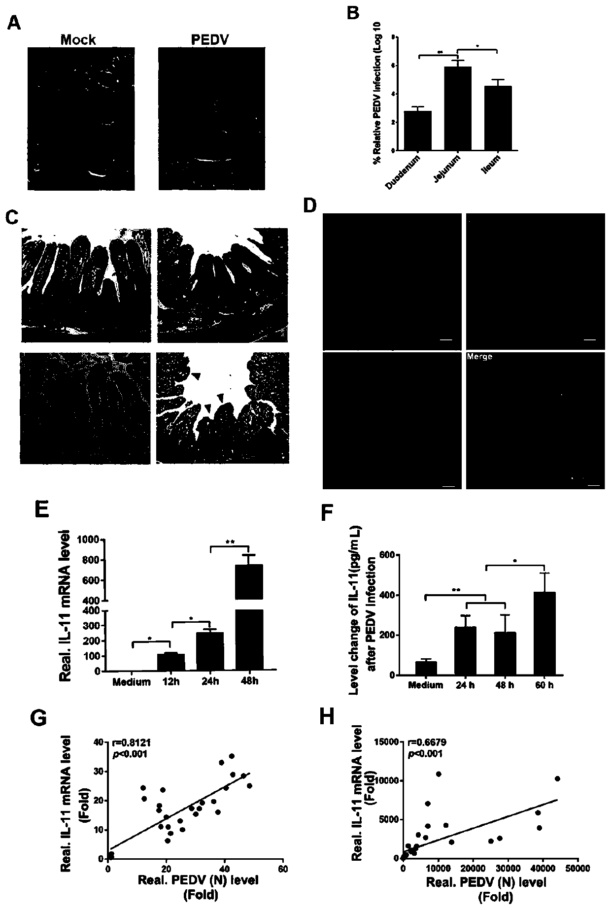 Purpose of porcine interleukin 11 in resisting porcine epidemic diarrhea virus infection