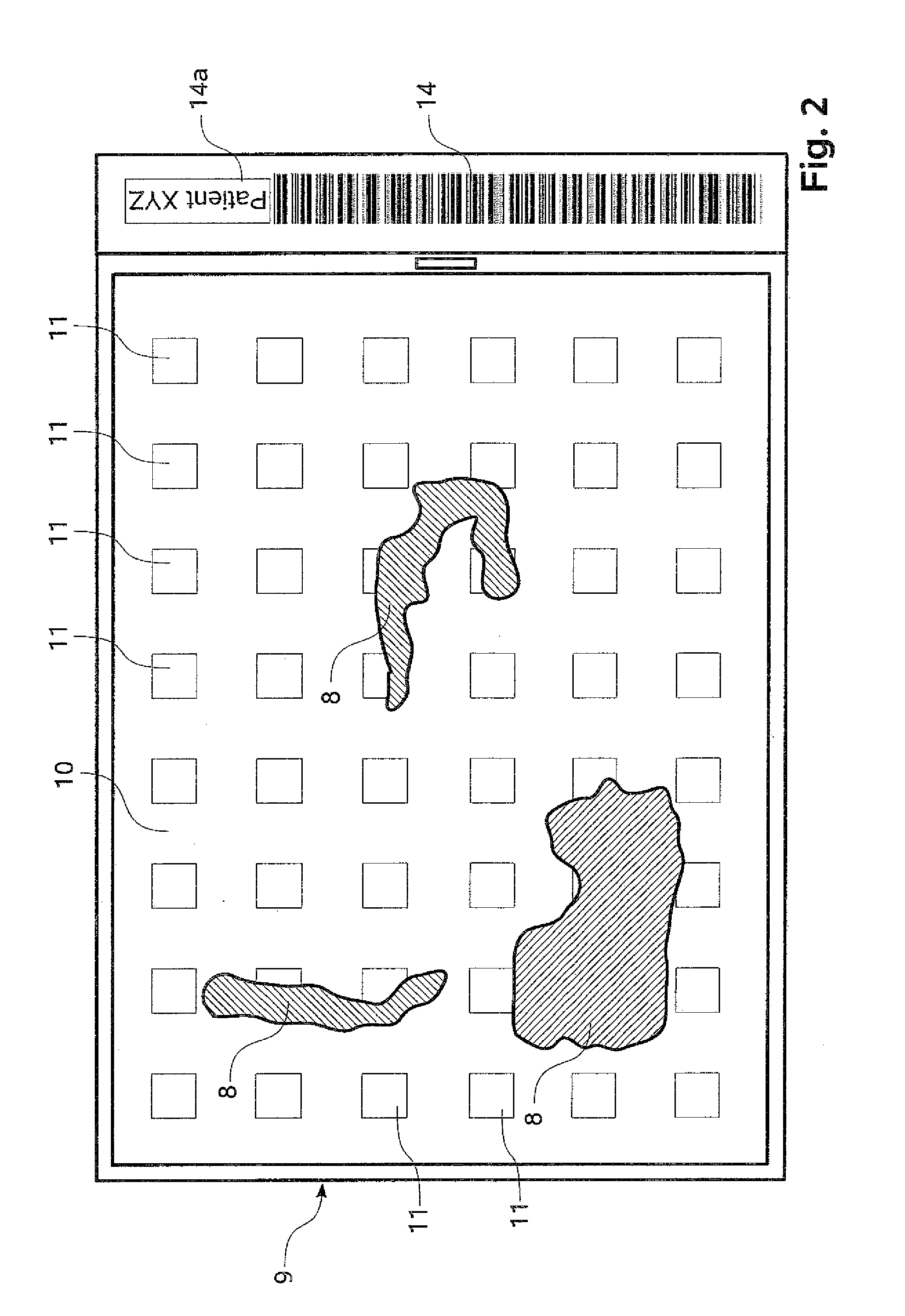 Tissue Embedding Apparatus, And Method For Operating A Tissue Embedding Apparatus