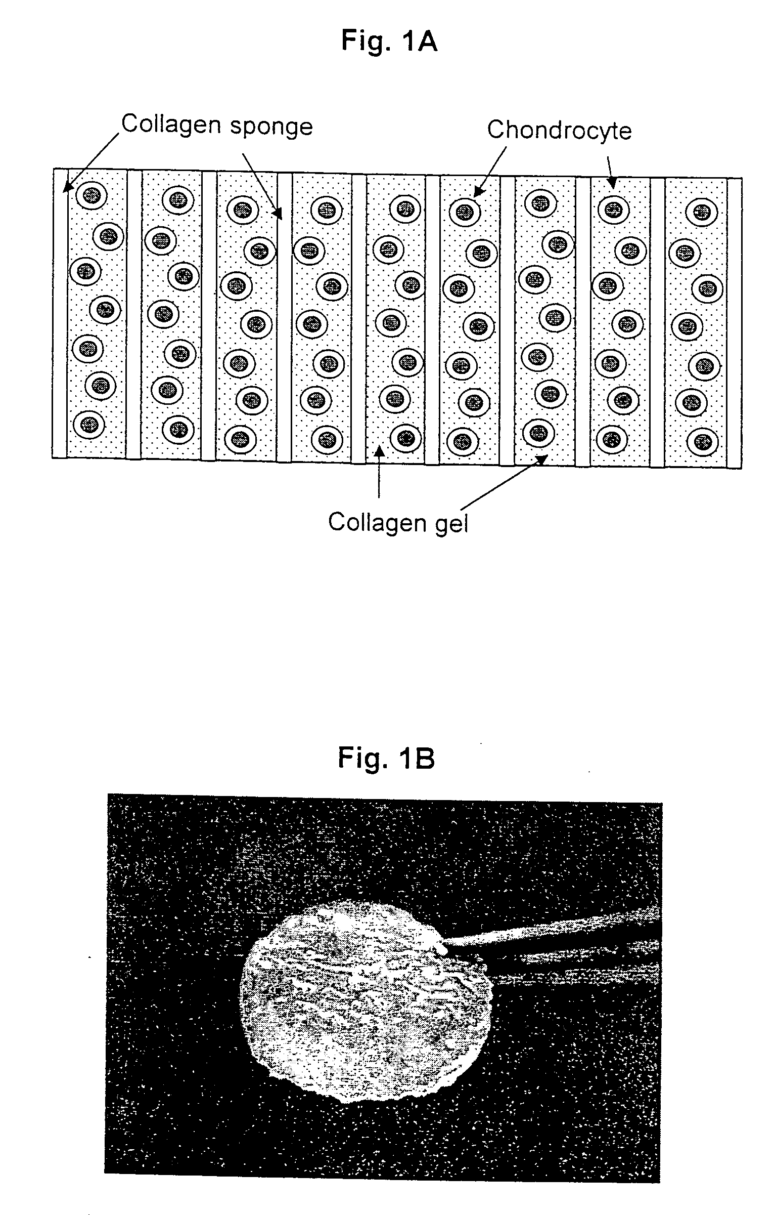 Method for in situ repair of injured, damaged, diseased or aged articular cartilage