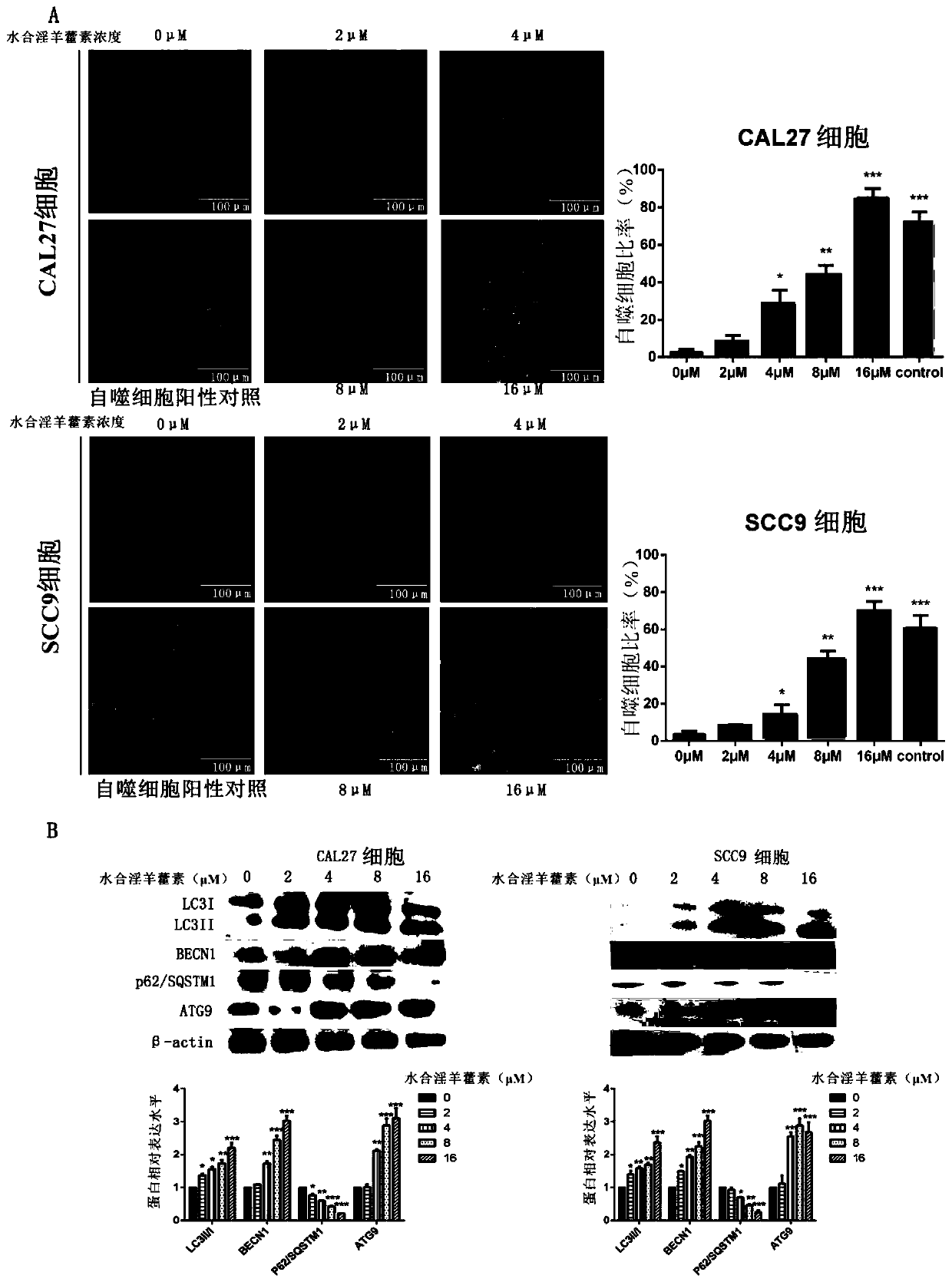 Application of icaritin hydrate for preparing medicine capable of inhibiting STAT3 (Signal Transducer and Activator 3 of Transcription) signal pathway and preventing and curing oral carcinoma