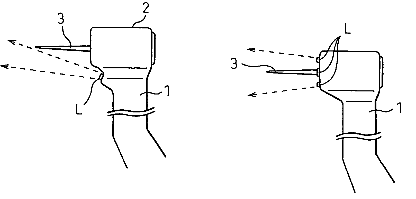 Dental diagnostic and treatment apparatus