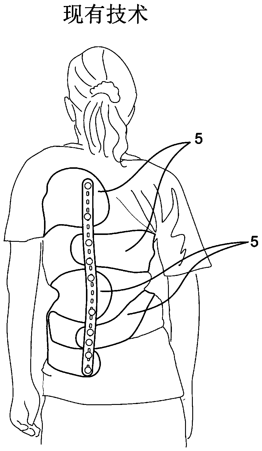 Segmented alignment rod assembly