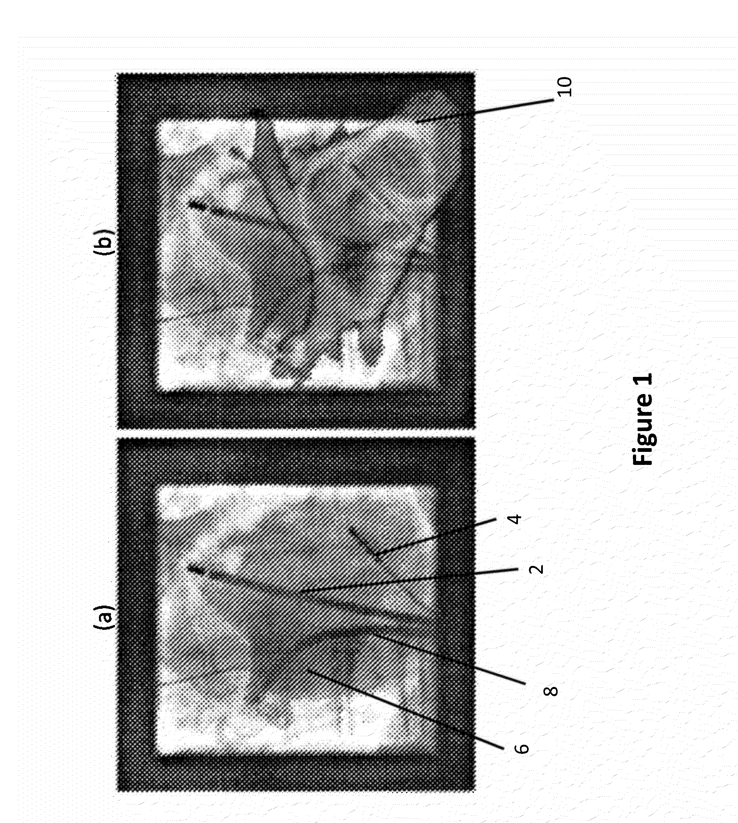 2d/3d image registration method