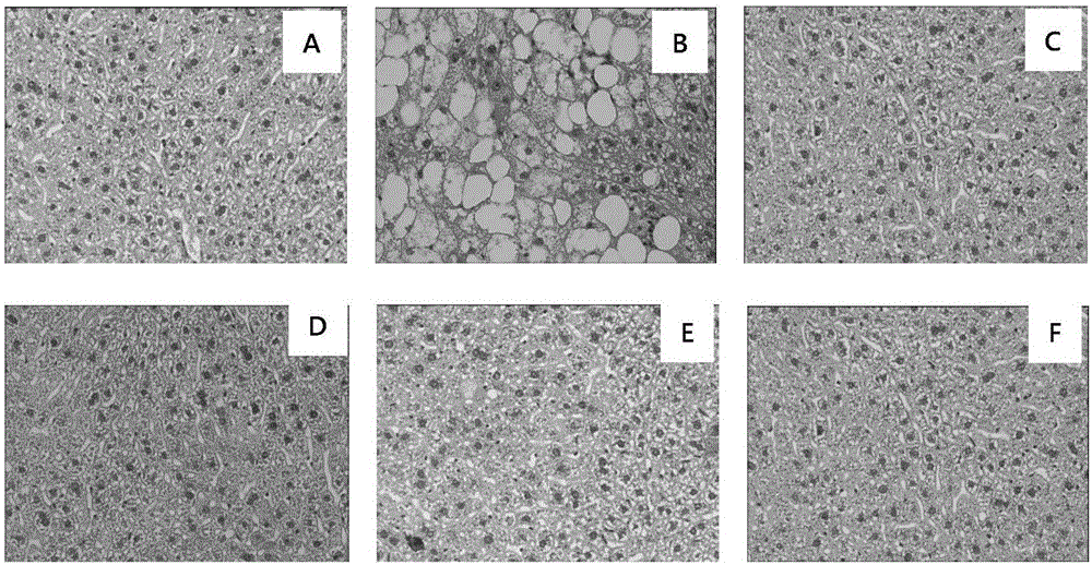 Application of p-dihydroxybenzene farnesyl compounds