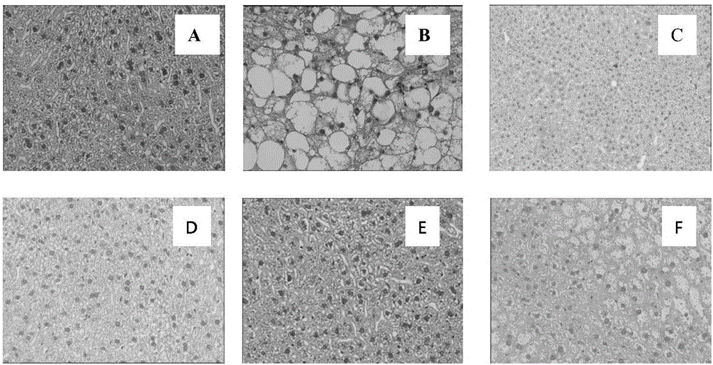 Application of p-dihydroxybenzene farnesyl compounds