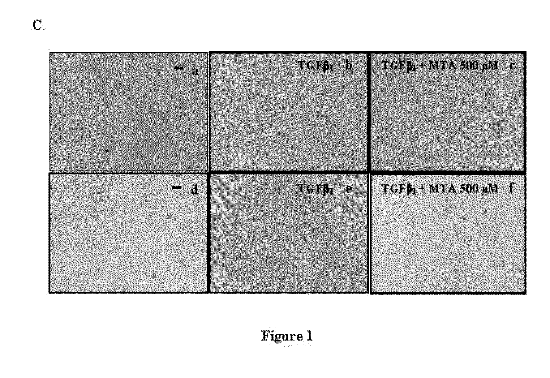 Compostions designed for the inhibition and/or blocking of the epithelial/mesenchymal transition