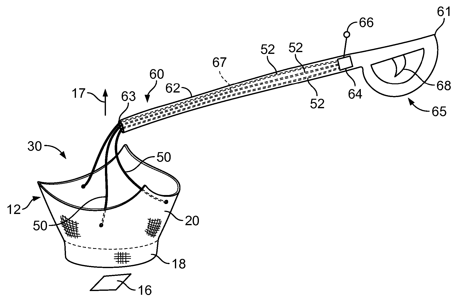 Multiple component prosthetic heart valve assemblies and methods for delivering them