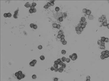 Messenger ribonucleic acid (mRNA) level in-situ hybridization detection kit for JAGGED1 in early stage of pathological change of breast cancer bone metastasis, and detection method and application