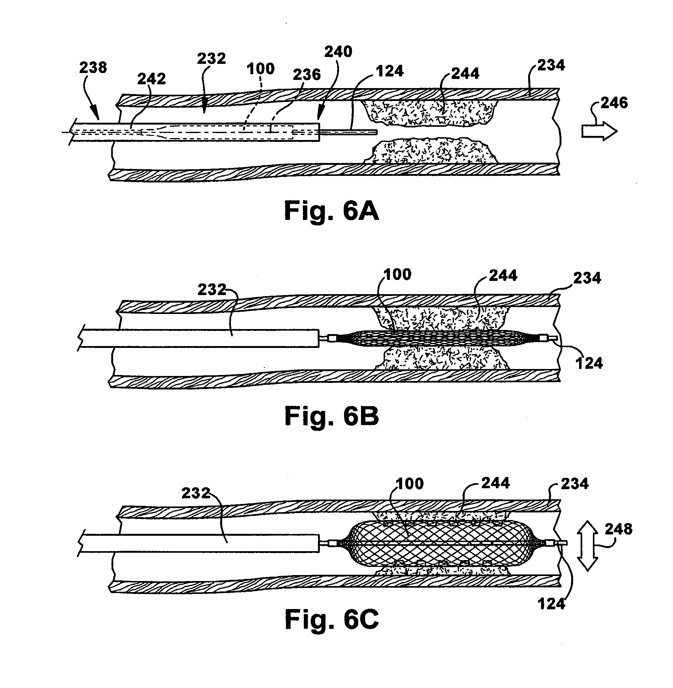 Method and apparatus for increasing blood flow through an obstructed blood vessel