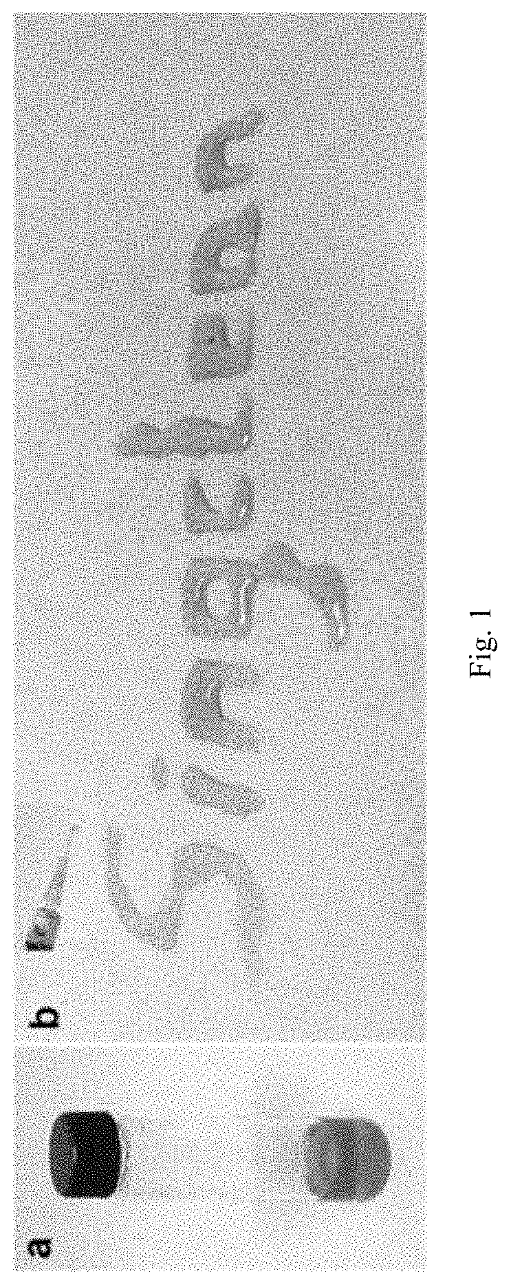 Injectable Temperature-sensitive Composite Hydrogel Containing Adipose-derived Mesenchymal Stem Cells and Preparation Method and Application Thereof