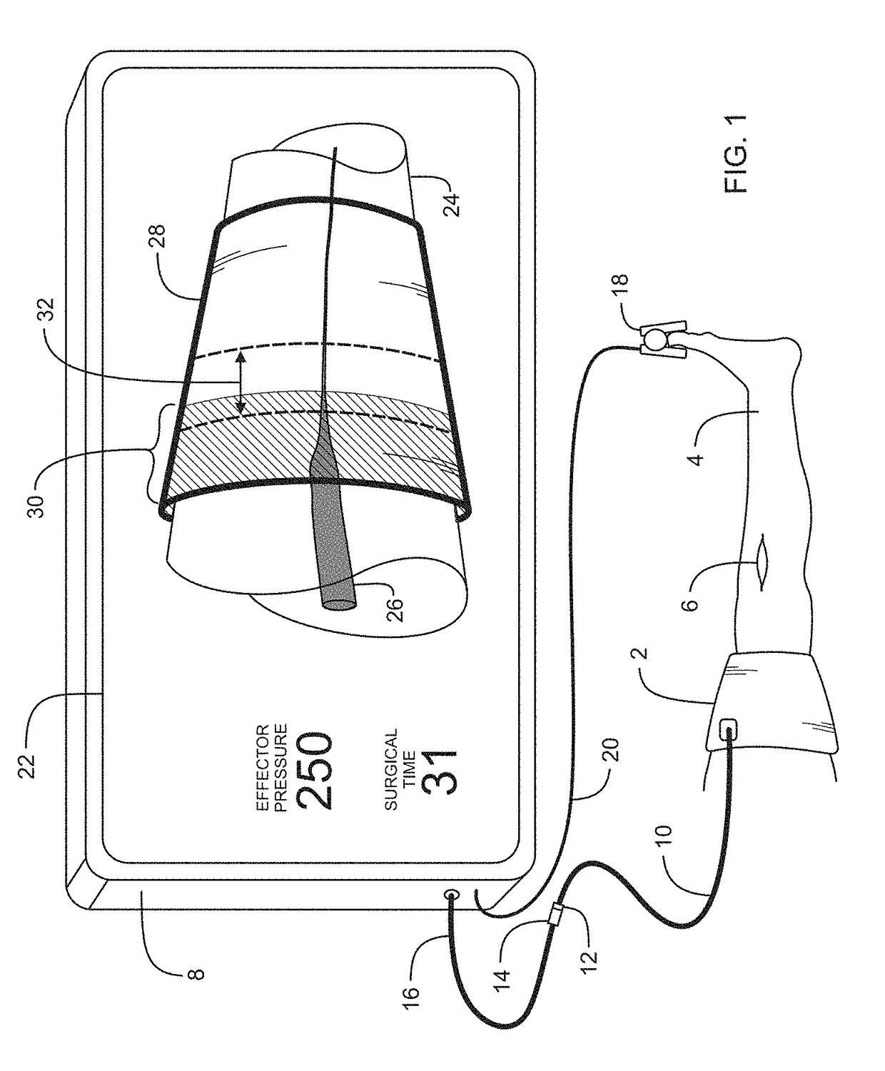 Personalized tourniquet apparatus