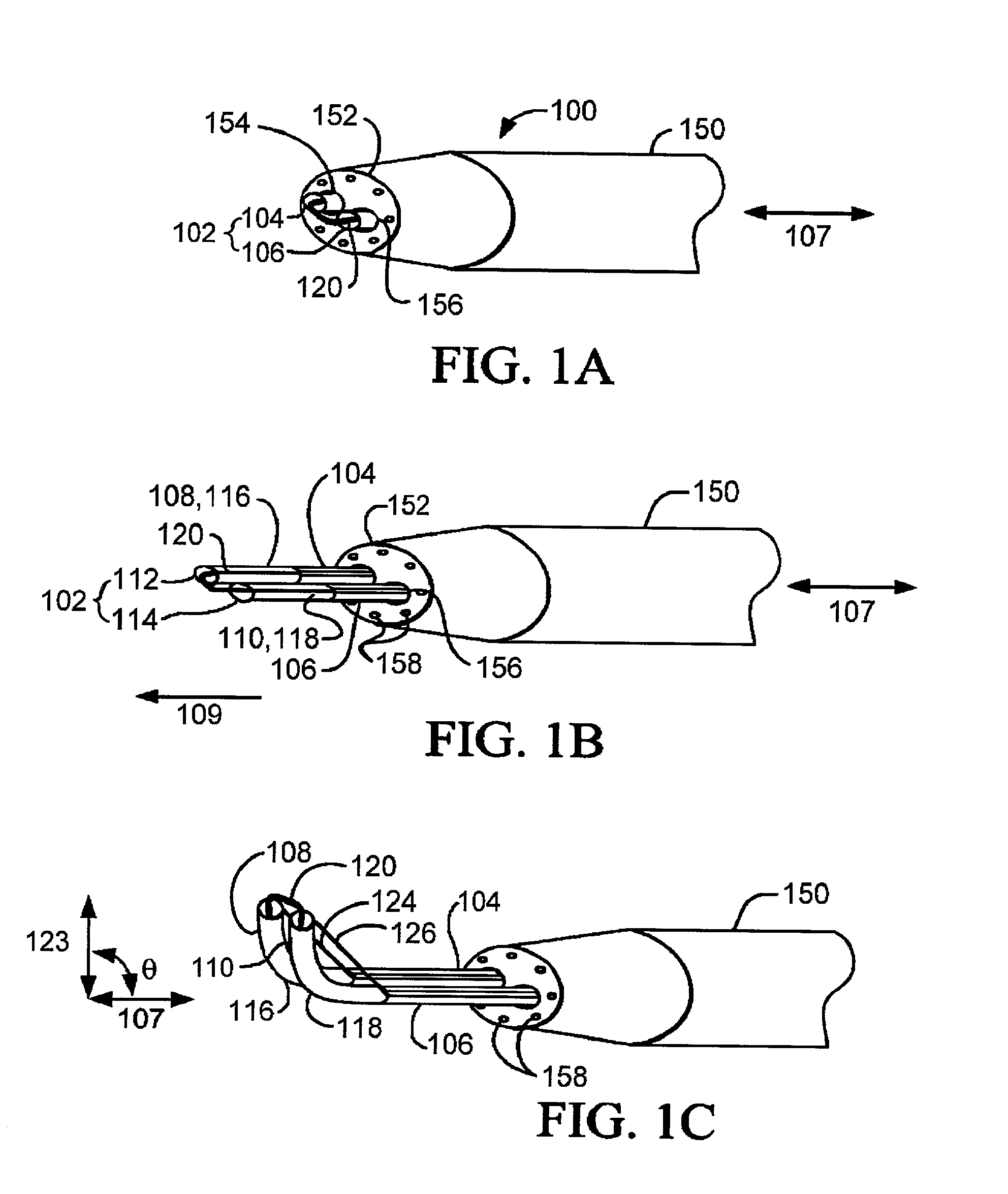 Devices and methods for tissue severing and removal