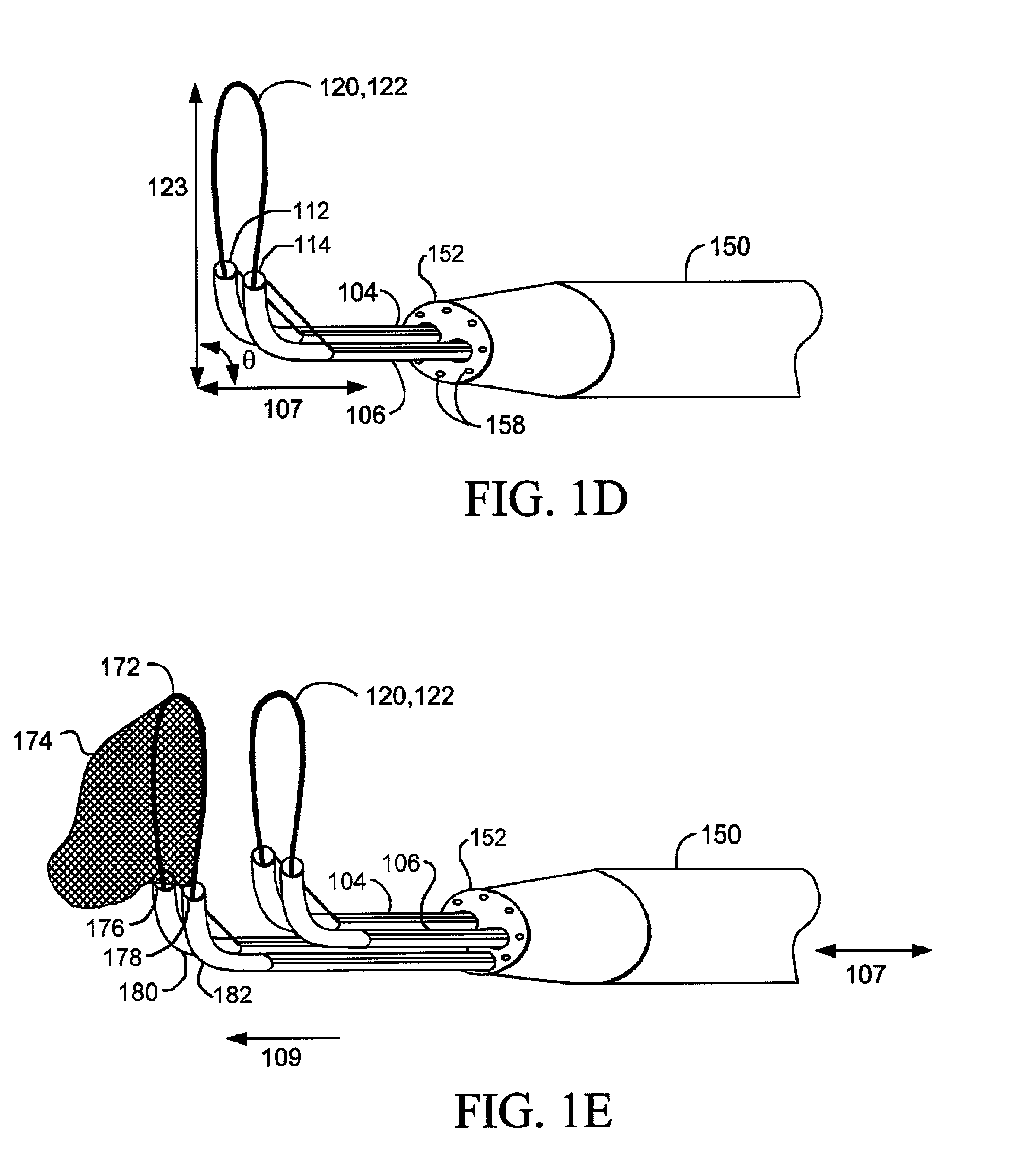 Devices and methods for tissue severing and removal