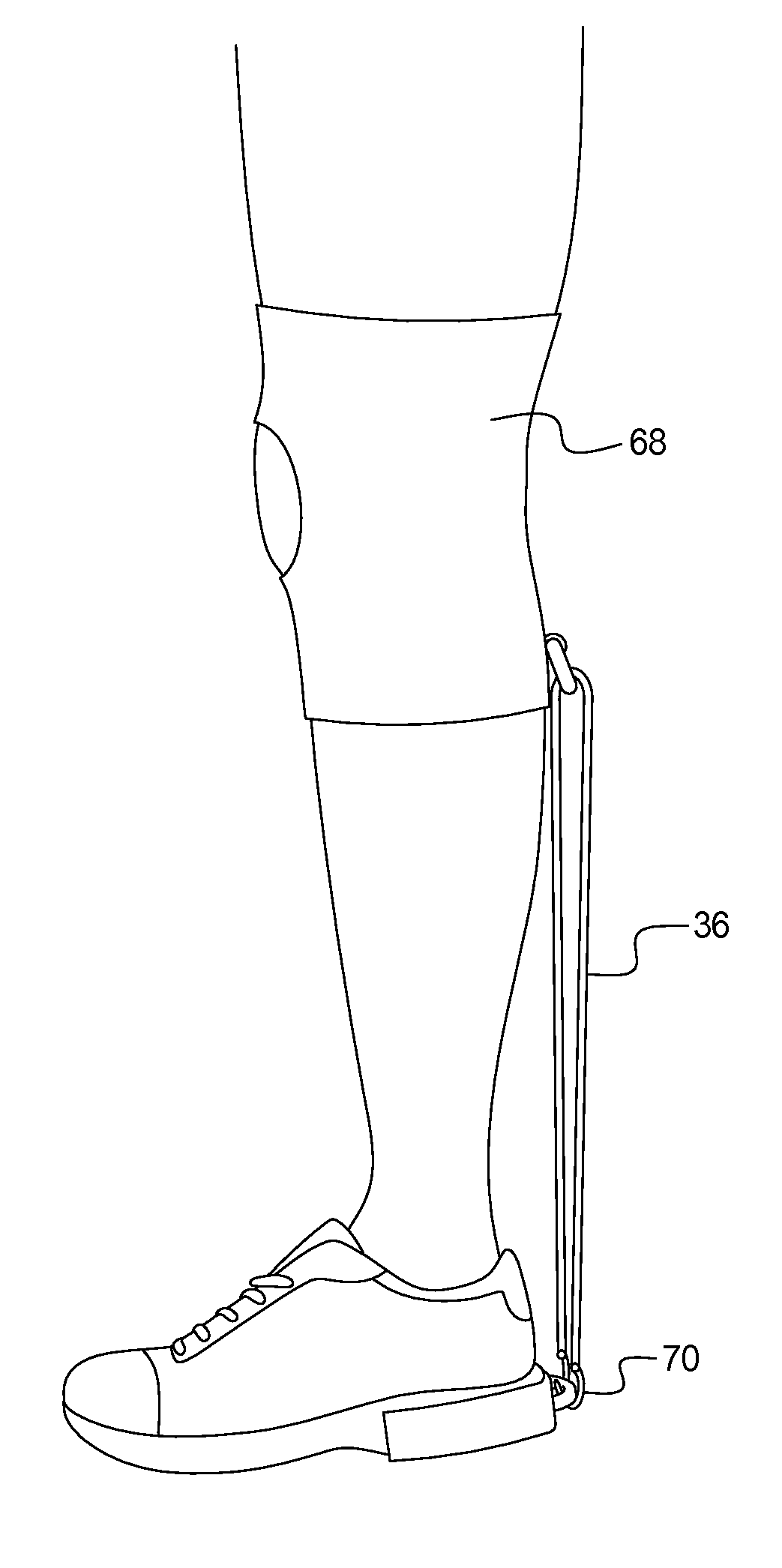 Device for mitigating plantar fasciitis