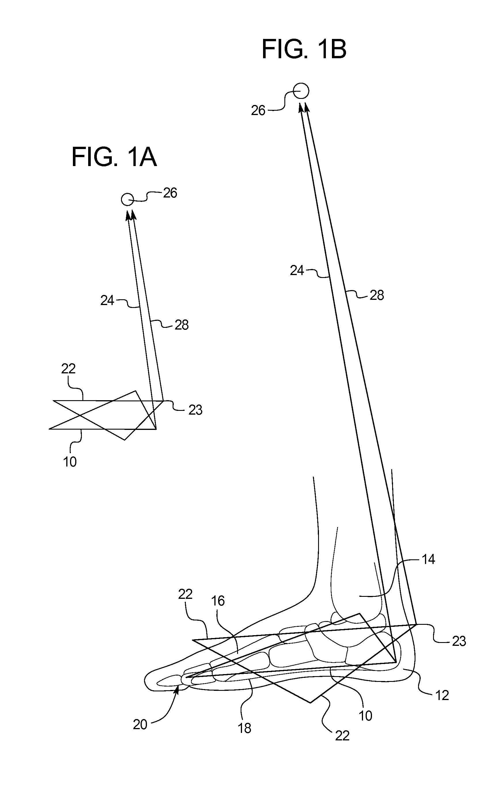 Device for mitigating plantar fasciitis