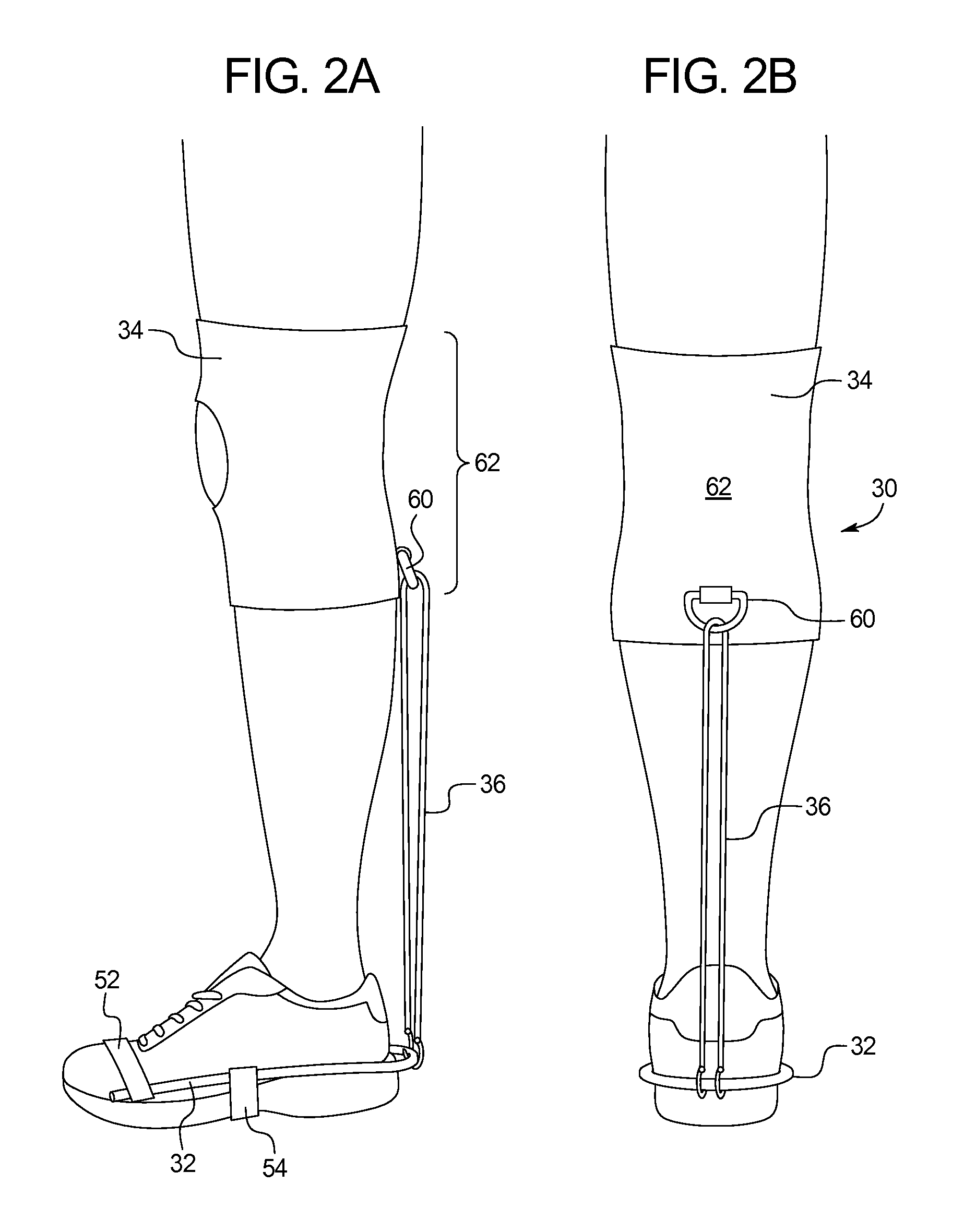 Device for mitigating plantar fasciitis