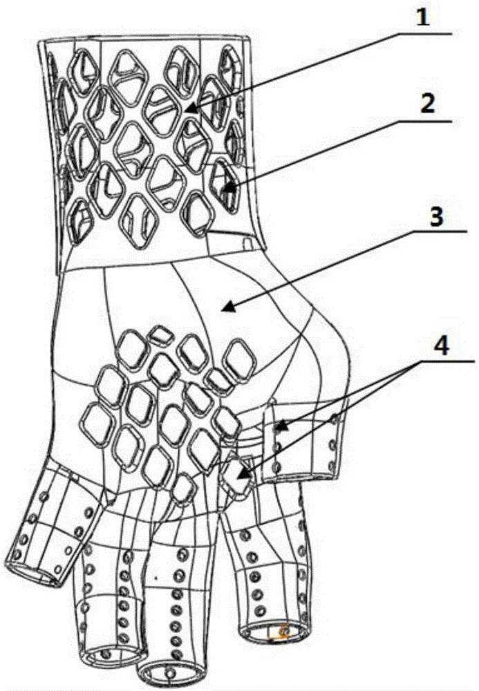 Customized anti-spasm upper limb orthosis rehabilitation aid based on 3D printing