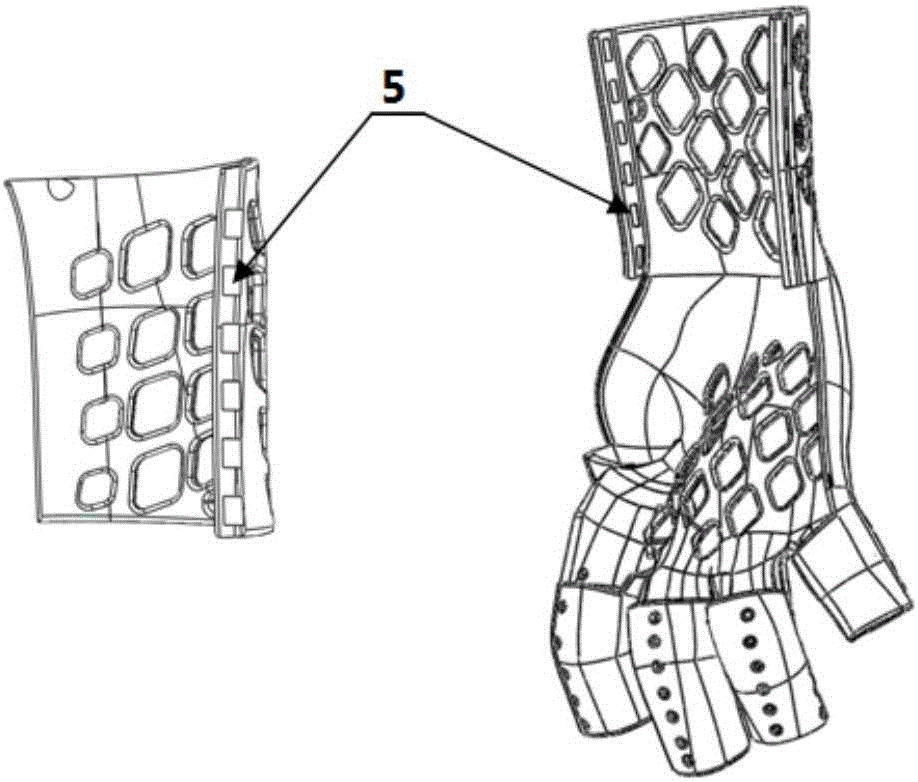 Customized anti-spasm upper limb orthosis rehabilitation aid based on 3D printing