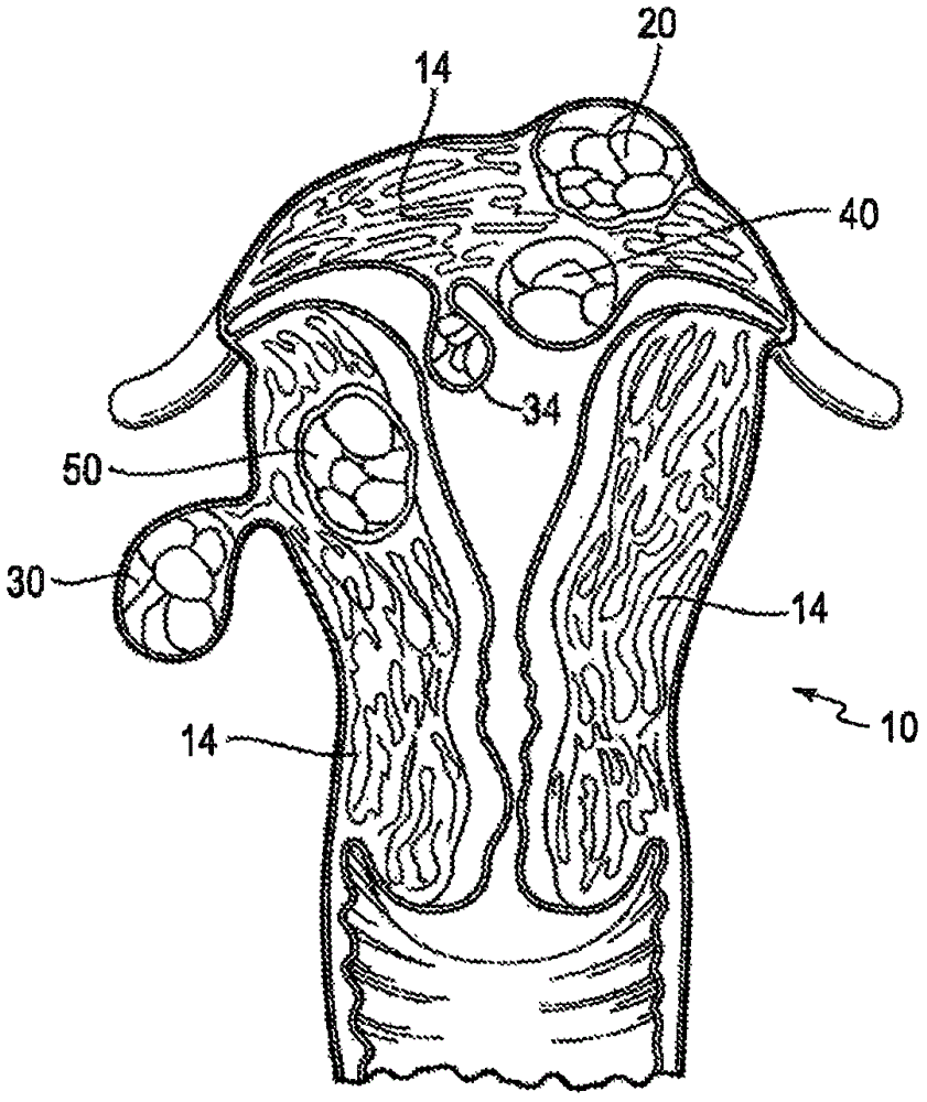 Electrosurgical system having grasper and snare with switchable electrode