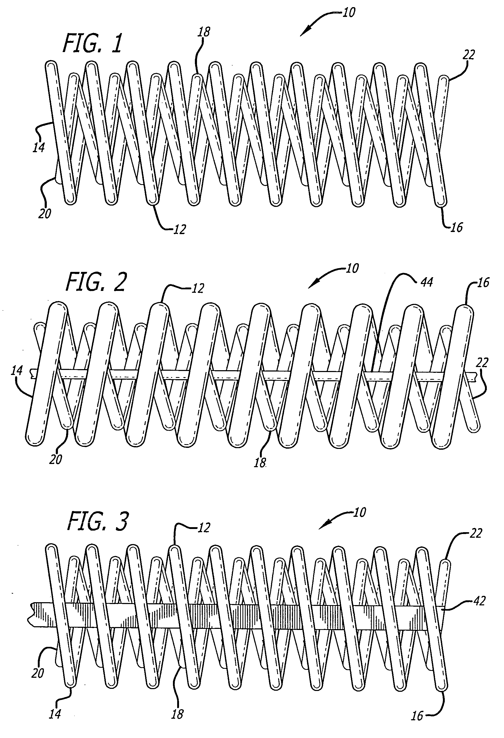 Vasoocclusive coil with biplex windings to improve mechanical properties