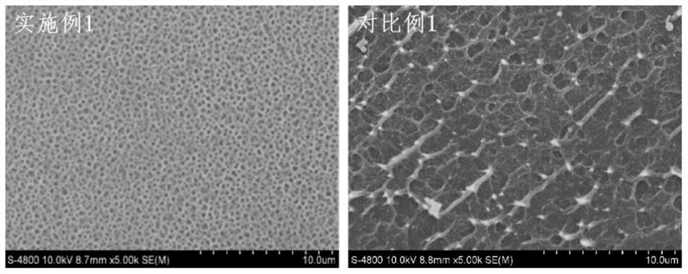 Super-hydrophilic chitosan quaternary ammonium salt hydrogel composite membrane as well as preparation method and application thereof