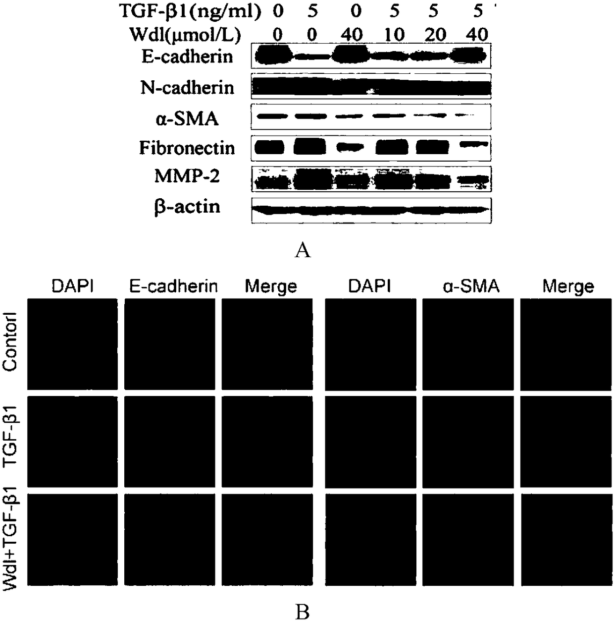 Application of wedelolactone in preparing drug for treating idiopathic pulmonary fibrosis