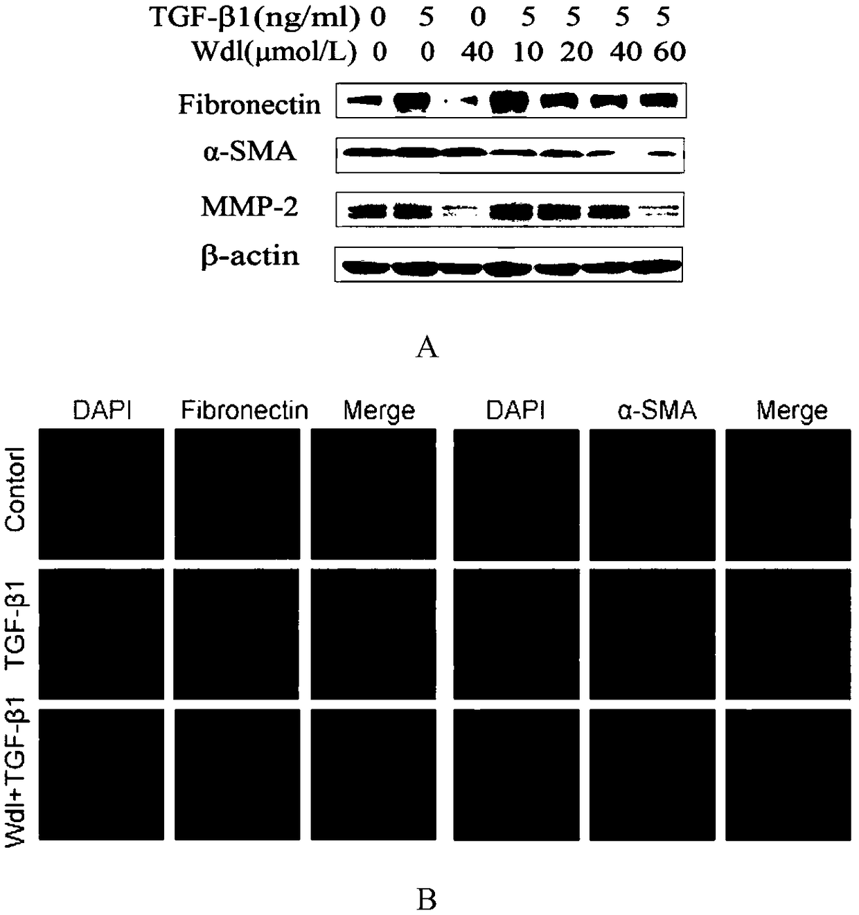 Application of wedelolactone in preparing drug for treating idiopathic pulmonary fibrosis