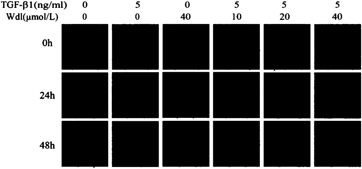 Application of wedelolactone in preparing drug for treating idiopathic pulmonary fibrosis