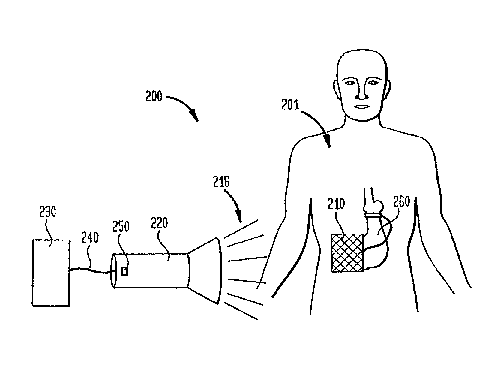 Powering implantable restriction systems using light