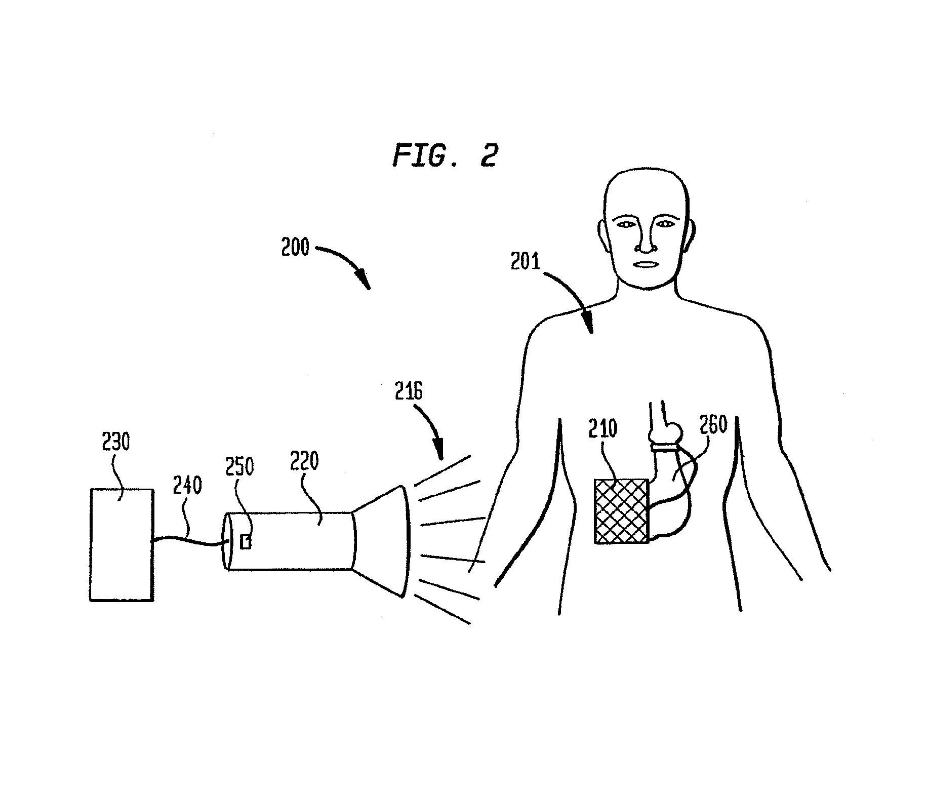 Powering implantable restriction systems using light