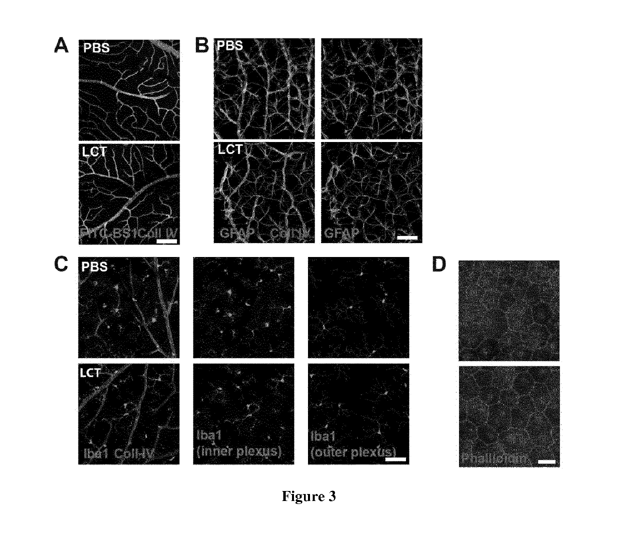 Lebecetin, a c-type lectin, as neovascularization inhibitor