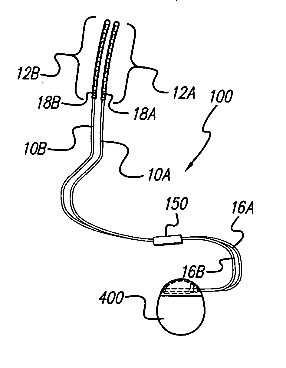 Operating room lead connector