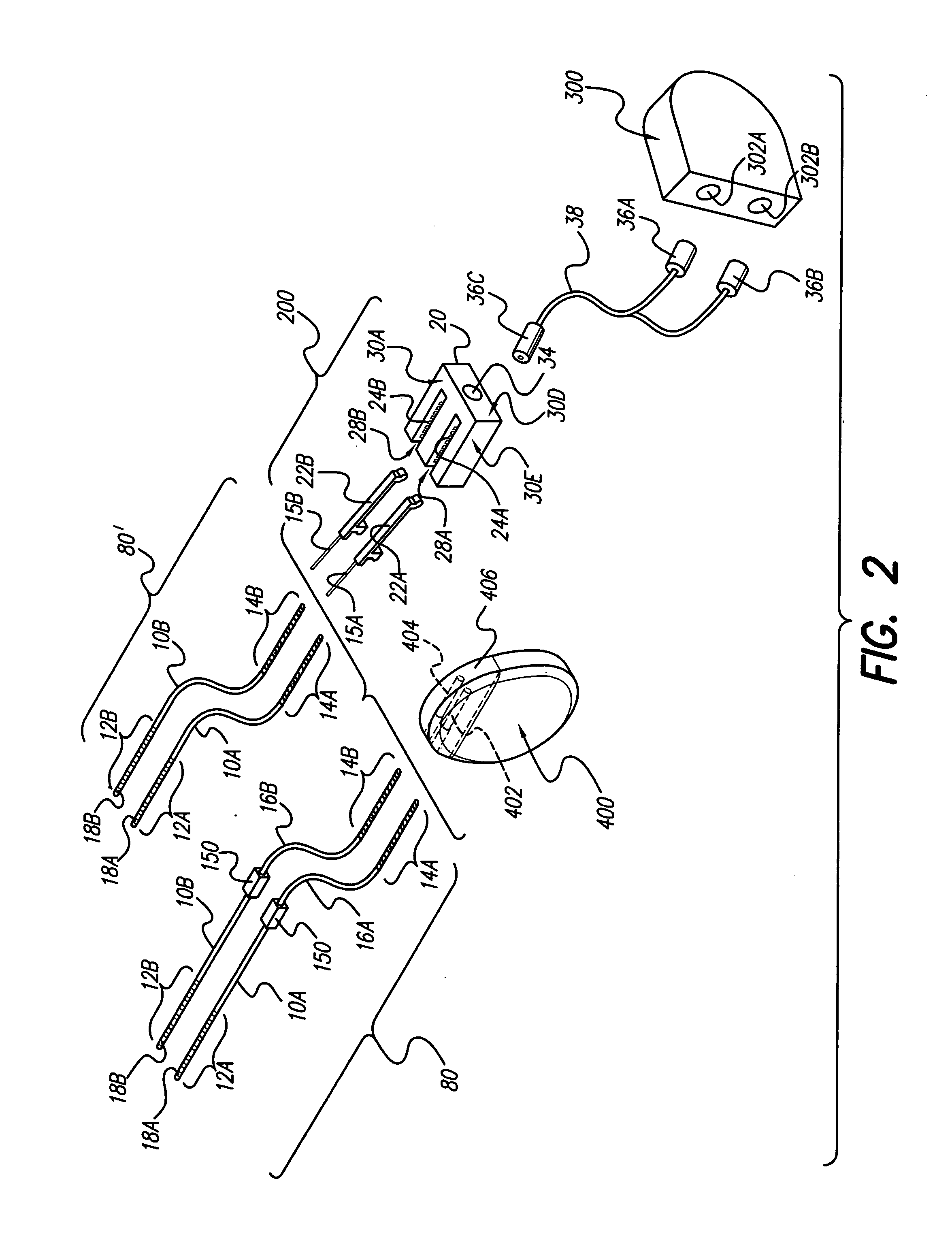 Operating room lead connector