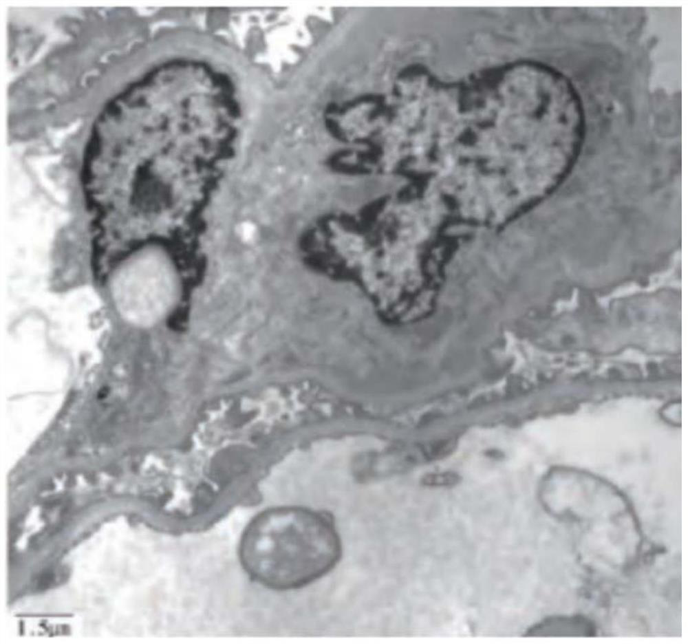 Improved method for cryopreservation of transmission electron microscope embedding medium