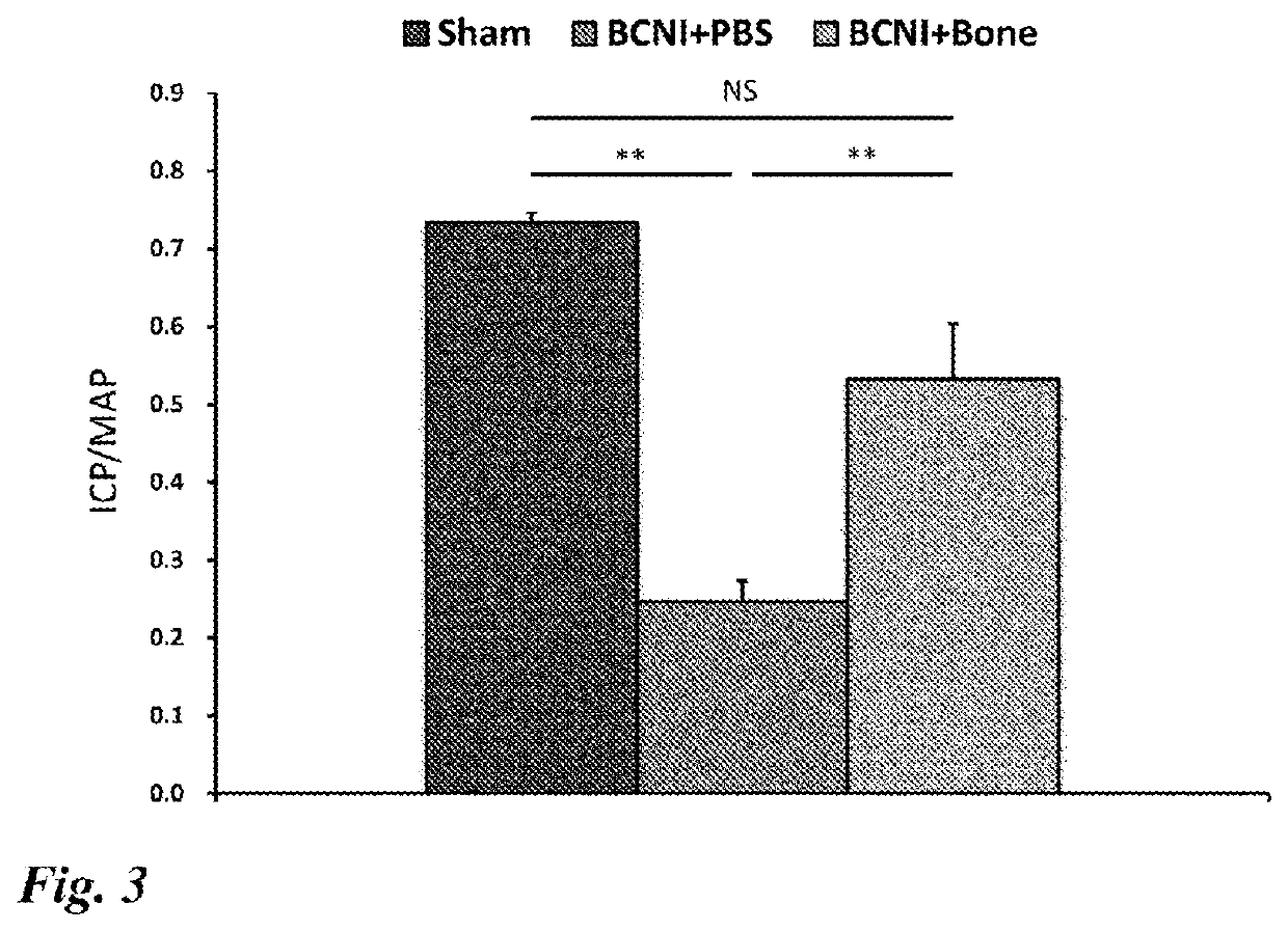 Erectile dysfunction therapeutic agent