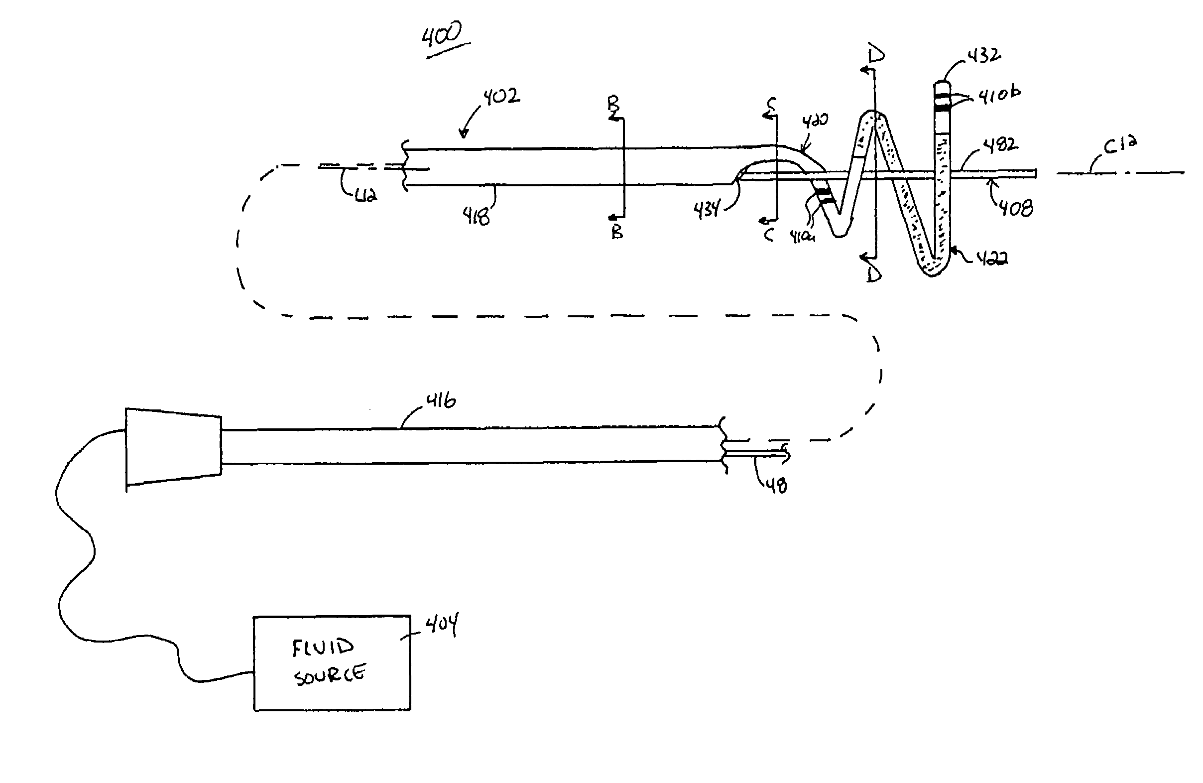 Ablation catheter assembly and method for isolating a pulmonary vein